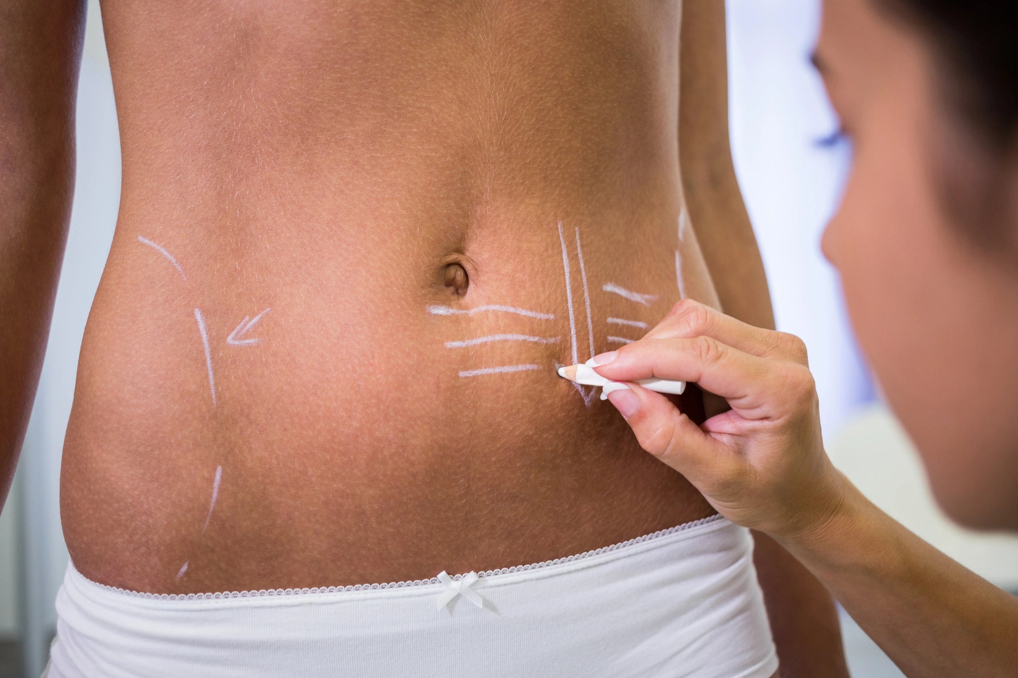 Liposuction Recovery Kit: Essentials for Faster Healing